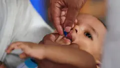 শিশুকে ভিটামিন এ ক্যাপসুল খাওয়ানো হচ্ছে